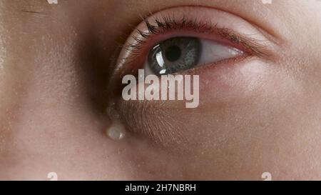 Close-up photo of the woman's tearing eye Stock Photo