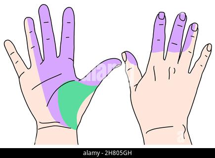 Carpal Tunnel Syndrome. median nerve Vector illustration doodle style Stock Vector
