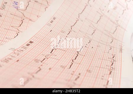 Close up of ECG, electrocardiogram. The work of a healthy heart on paper. Stock Photo