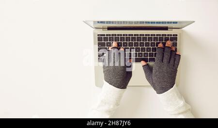 Man with rheumatoid arthritis wearing compression gloves while working on computer Stock Photo