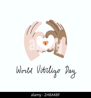 Swarthy hands with vitiligo make a heart shape gesture. Card of world vitiligo day Stock Vector