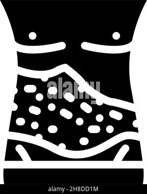 shingles skin disease glyph icon vector illustration Stock Vector