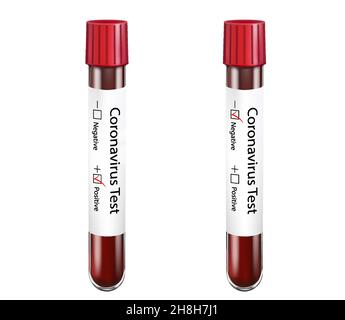 Test tubes with positive and negative results for coronavirus, isolated on white background. Chinese coronavirus or Covid 2019 blood test concept. Vec Stock Vector