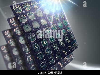 CT scan result of a human brain as a concept of future health. Stock Photo