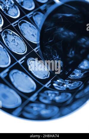 Patient's head scan on the light box in the hospital. Stock Photo