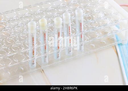 Tube containing a swab sample for COVID-19 that has tested positive of new version Omicron of coronavirus with testing for presence Stock Photo