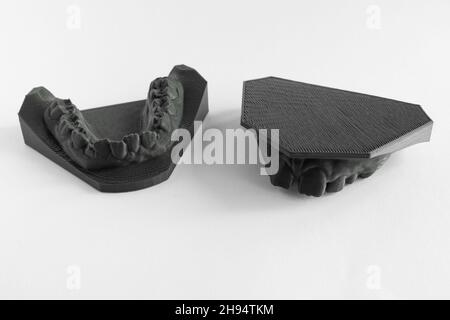 3D printer denture girl 9 years dentistry Stock Photo