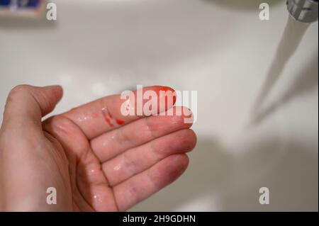 Blood on a numan fingers. Nose bleeding. Stock Photo