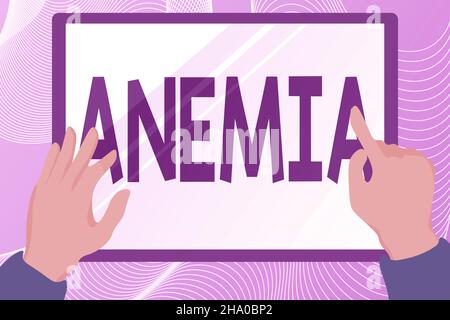 Text sign showing Anemia. Business overview condition where there deficiency of red cells of haemoglobin in blood Hands Illustration Holding Drawing
