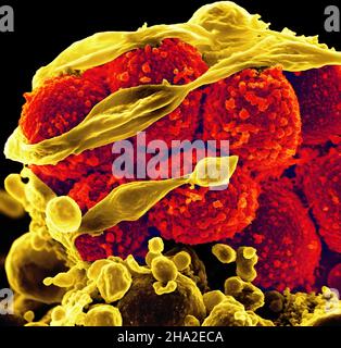 Methicillin-resistant staphylococcus aureus (mrsa) bacteria Stock Photo