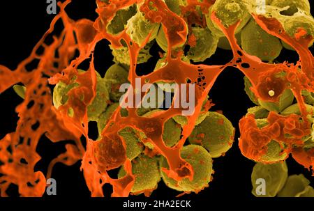 Scanning electron micrograph of methicillin-resistant Staphylococcus aureus (MRSA, yellow) surrounded by cellular debris. MRSA resists treatment with Stock Photo