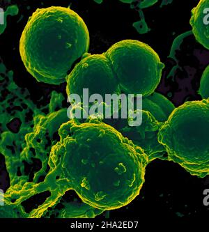 Scanning electron micrograph of neutrophil ingesting methicillin-resistant Staphylococcus aureus bacteria. Stock Photo