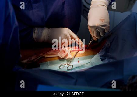 Surgeon making surgery of hospital in operating room with open wounds on leg Stock Photo