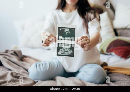 A pregnant unrecognizable woman holds an ultrasound scan of a human fetus in front of her. Stock Photo