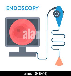 Endoscopy, conceptual illustration. Stock Photo