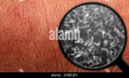 Searching for bacteria on human skin Stock Photo