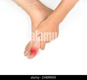 Inflammation of Asian young man’s big toe. Concept of foot joint pain, arthritis, hyperuricema or gout. Isolated on white. Stock Photo
