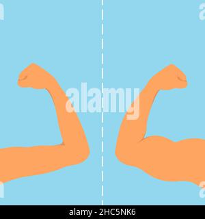 Strong versus weak arm, conceptual illustration Stock Photo