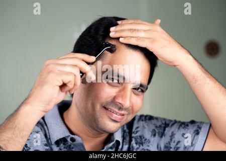 Close up head shot of Handsome Young Man using derma roller on scalp to regrow fallen hair by looking at camera at home - concept of haircare Stock Photo