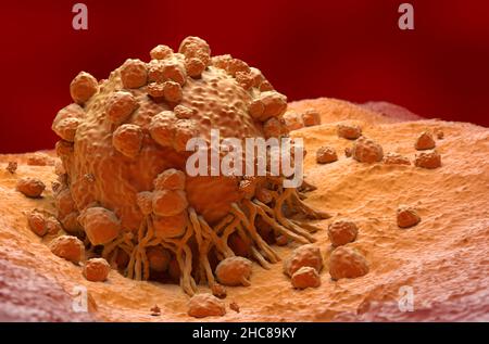 Melanoma cell a type of skin cancer top view 3d illustration Stock ...