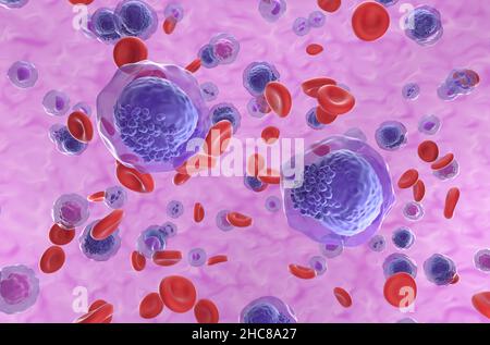 Acute myeloid leukemia (AML) cells in blood flow - isometric view 3d illustration Stock Photo