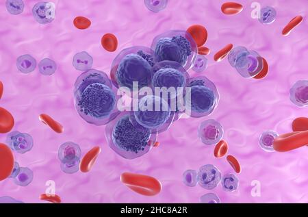 Acute myeloid leukemia (AML) cells cluster in blood flow - isometric view 3d illustration Stock Photo