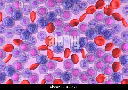 Acute myeloid leukemia (AML) cells field - top view 3d illustration Stock Photo