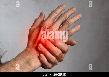 Pain in the hand of Southeast Asian elder man. Concept of hand pain, arthritis and tendon problems. Stock Photo