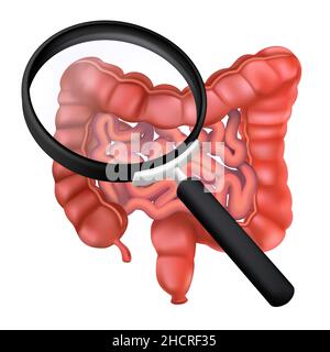 Realistic human intestines under a magnifying glass. 3D vector illustration of the colon. Studies of the gastrointestinal tract. Anatomical concept of Stock Vector