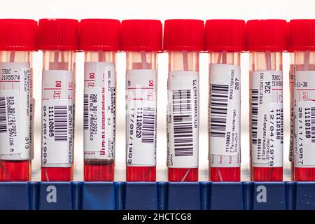 Real series of molecular PCR test tubes, nasal and oropharyngeal swabs with red reagent in vials, testing for Sars Cov-2, Covid-19 or Coronavirus Stock Photo