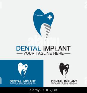 Dental implant logo vector  designs concept ,  Dental Clinic &Care logo template Stock Vector