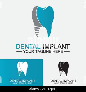 Dental implant logo vector  designs concept ,  Dental Clinic &Care logo template Stock Vector