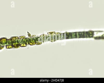 Blue-green filamentous algae under microscopic view, cyanobacteria ...