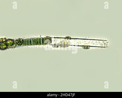 Blue-green filamentous algae under microscopic view, cyanobacteria ...