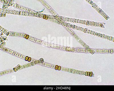 Nodularia algae under microscopic view, x100, nitrogen-fixing ...