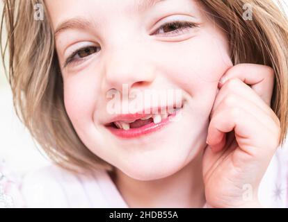 A young girl with two deciduous front incisor teeth missing and two front secondary incisor teeth beginning to grow Stock Photo