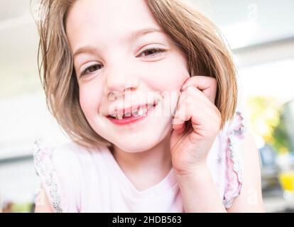 A young girl with two deciduous front incisor teeth missing and two front secondary incisor teeth beginning to grow Stock Photo