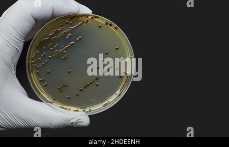 Black bacteria colonies on Selective media Agar Plates in petri dish  Stock Photo