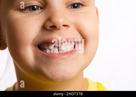 Little girl face smiling showing missing front baby tooth looking away on white background. First teeth changing going to dentist to do tooth Stock Photo