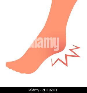 Leg with heel pain. Orthopedic disease plantar fasciitis. Beauty and health of feet. Vector isolated illustration Stock Vector