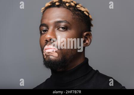 portrait of african american man with vitiligo skin and stylish hairstyle looking at camera isolated on grey Stock Photo