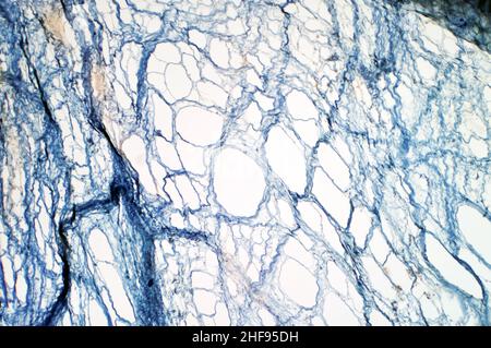 areolar loose connective tissue