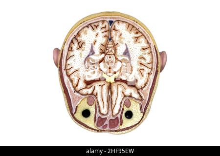 Transverse-section illustration of the human brain Stock Photo - Alamy