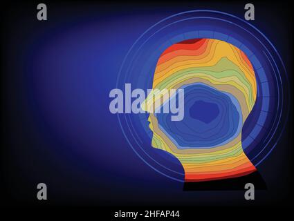 Source imaging of human epileptic focus at temporal region. Illustration of multicolor band in human head representing different polarity of electrica Stock Vector
