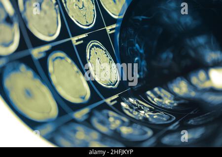 Human brain scan testing film folded in a roll, medical background with space for your design. Stock Photo