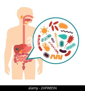 medical vector illustration of stomach ache, human digestive system problems Stock Vector