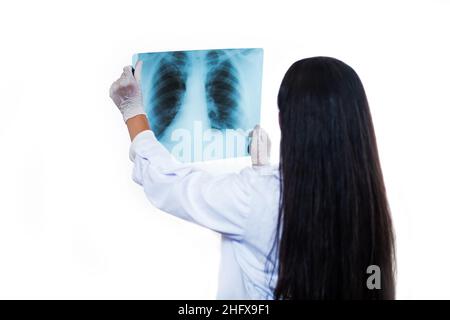 X-ray of the chest in the hands of a doctor. a doctor with long dark hair in a white coat and protective gloves holds in his hands. The doctor examine Stock Photo