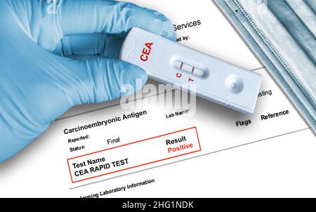 Carcinoembryonic Antigen (CEA) positive test result by using rapid testing device held by hand in medical glove with medical face mask in background. Stock Photo