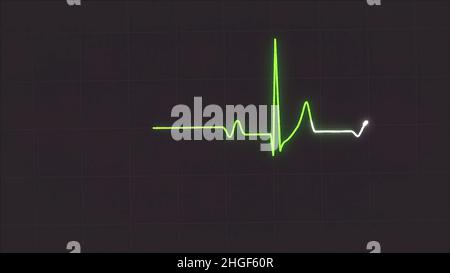 Abstract EKG Monitor showing heart beat on grey background. Electrocardiogram green pulse waves in motion Stock Photo