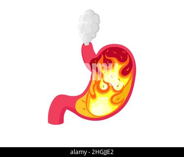 Stomach heartburn with burning acid inside. Digestive system gastritis problem. Indigestion and belly disease. Abdominal gastric pain from fire. Gastroesophageal reflux vector eps illustration Stock Vector